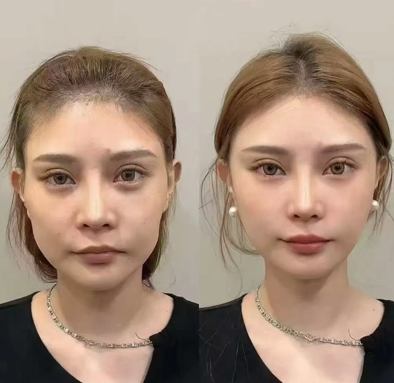 五、体检现场：疤痕成因会影响更终结论