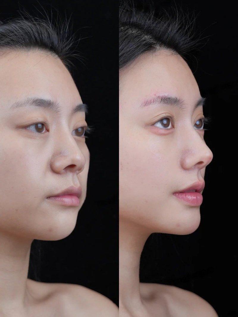 二、为何“土方去眼袋的小偏方”不靠谱