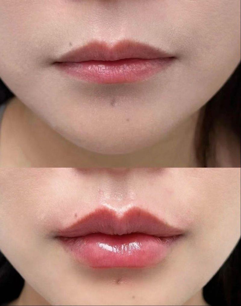 三、别再纠结“更有成效去眼袋的土方法是什么”，先分清楚眼袋类型