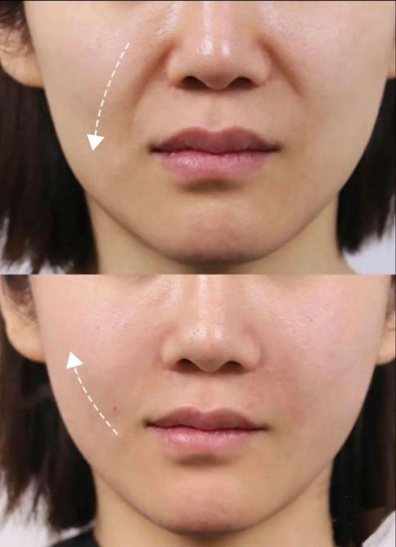 专精手术矫正：更持久有效的改善方案