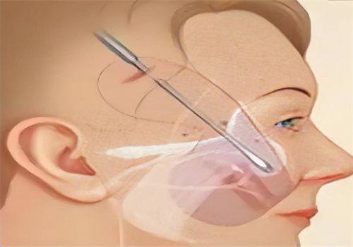 新疆王蛟整形医院擅长项目：