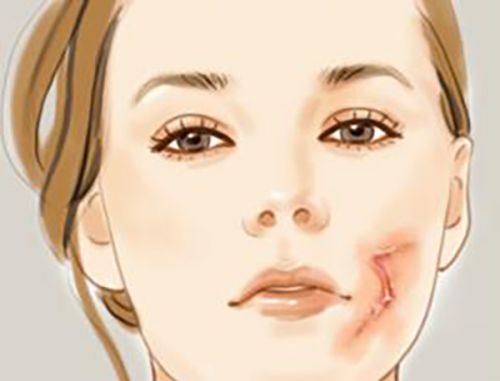 二、双眼皮手术常见风险类型解析