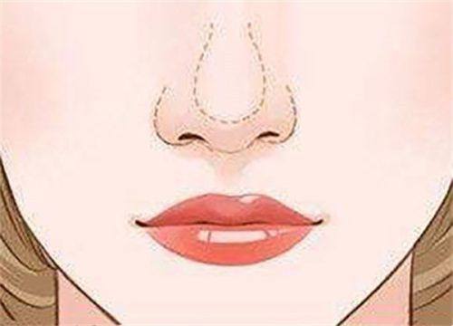 四、假体隆胸a可以到d杯吗?关键限制条件是什么