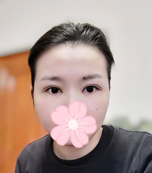 重庆新桥医院整形美容科地址电话及营业时间：