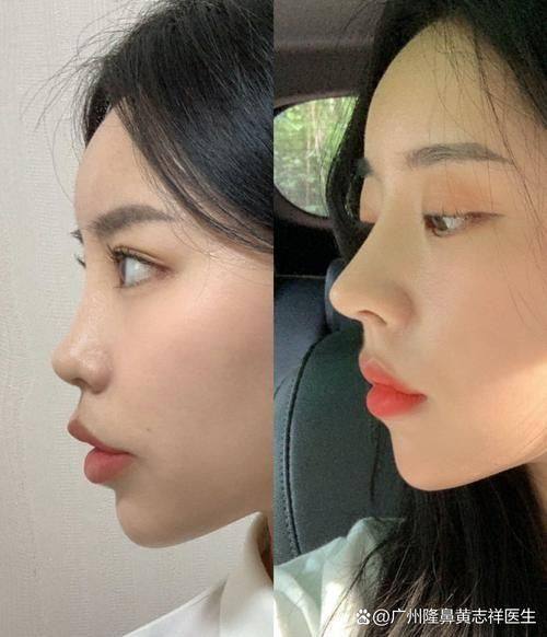 凤城美人屋医疗美容诊所擅长项目: