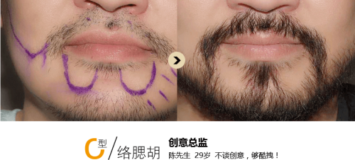 广东深圳青逸植发预约挂号方式