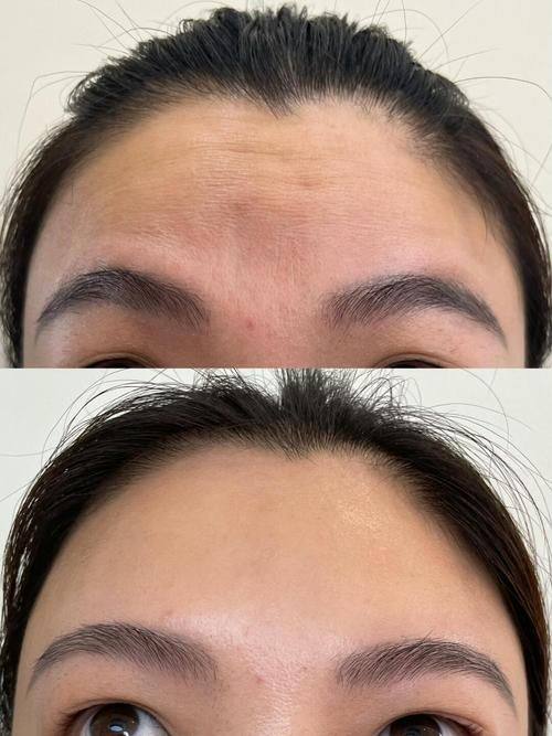 重庆宝丽医疗美容医生名单及擅长领域：