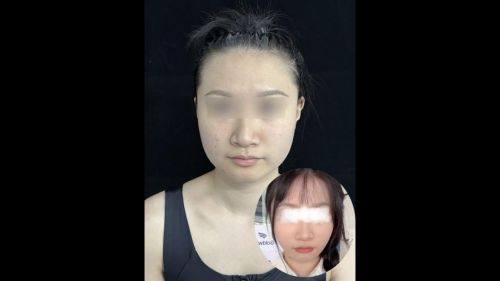 凤城美人屋医疗美容诊所口碑评价