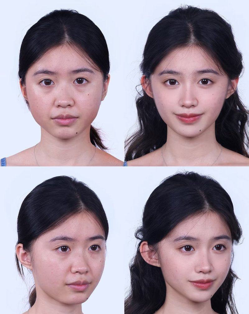 三、腹部开刀史对考军校的体检影响