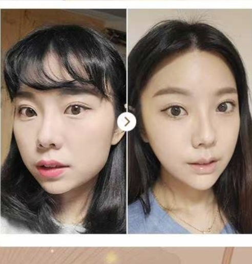 四、预防疤痕色沉，比忌酱油更重要的事