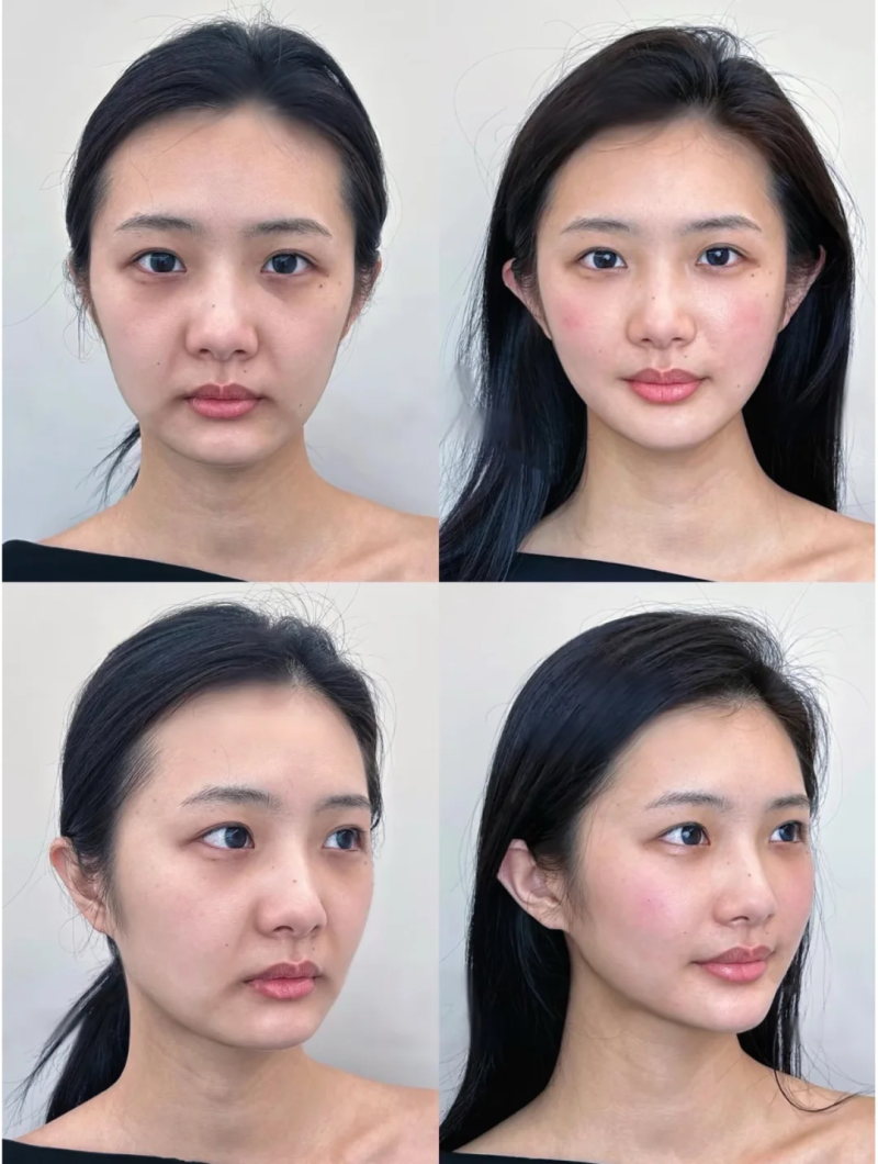 凤城美人屋医疗美容诊所价格表