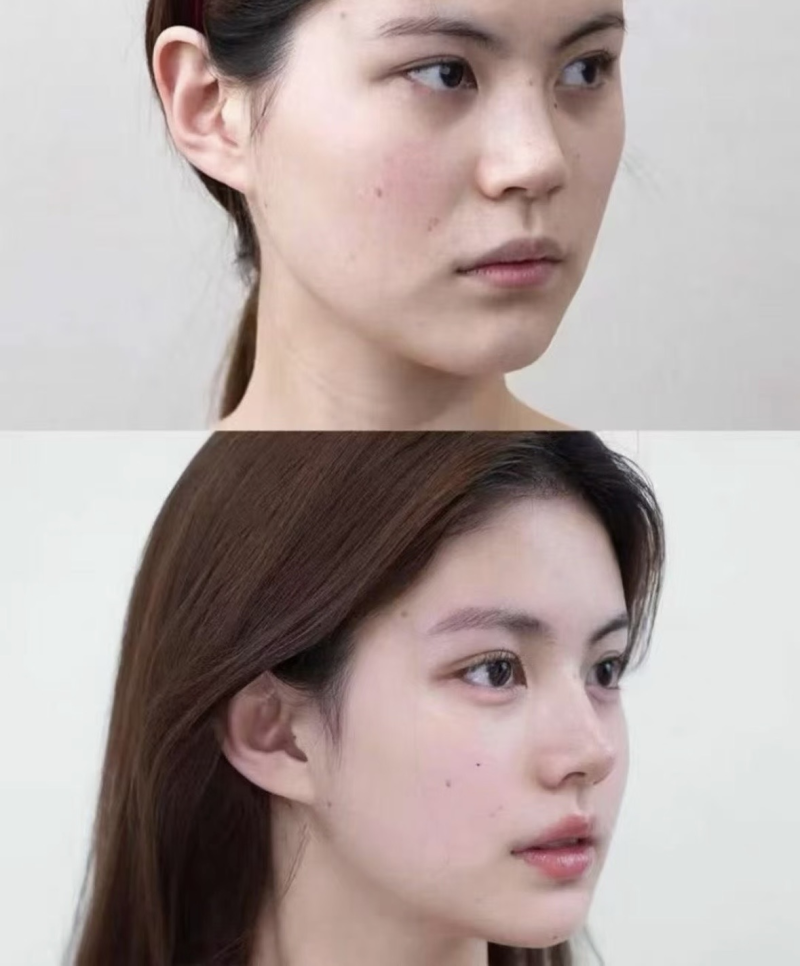 成都舒百颜医疗美容门诊部价格表