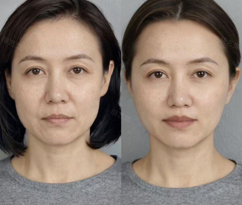 五、住院一周左右：传统手术的系统护理需求