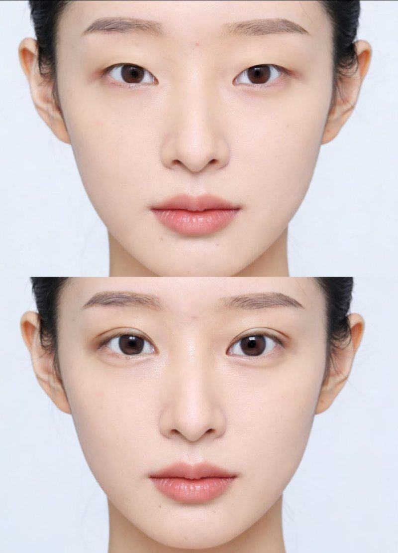 深圳王狮传奇医疗美容门诊部预约挂号方式