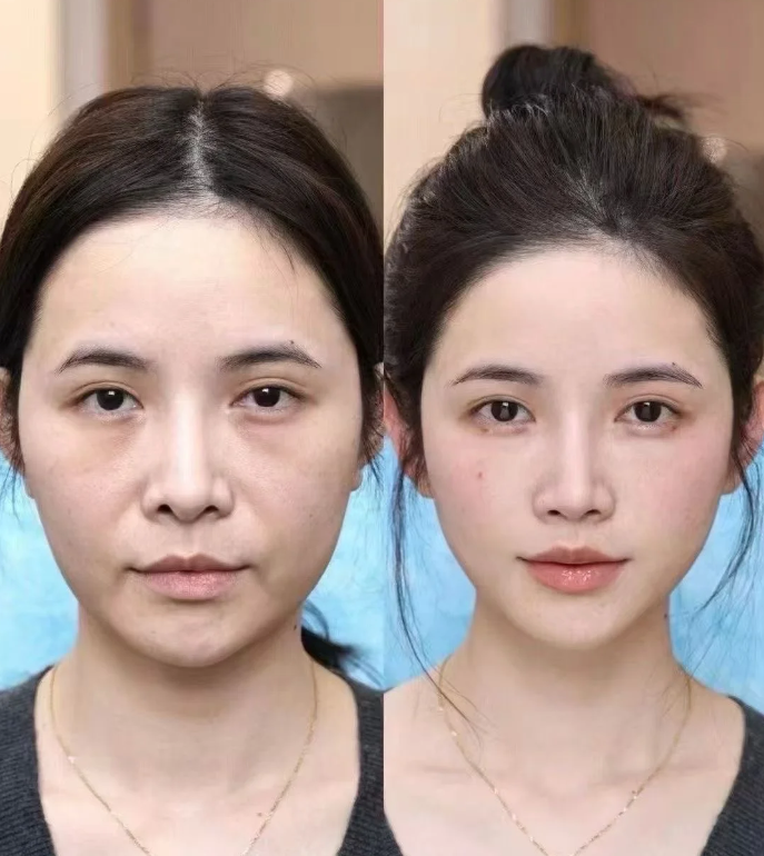 重庆新桥医院整形美容科怎么样？