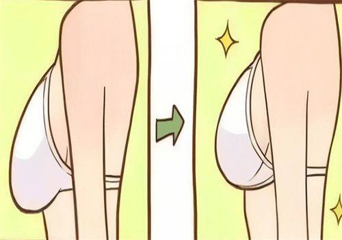 五、烫伤疤痕疙瘩治疗的核心:早干预+个性化匹配