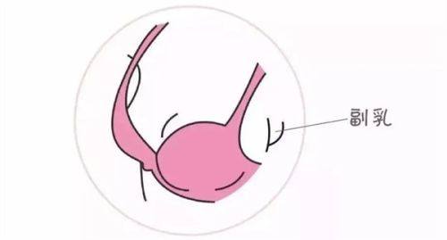 三、已形成的轻度缝线疤痕,非手术修复方法