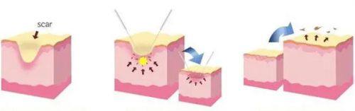 二、不同工作性质,复工时间要灵活调整