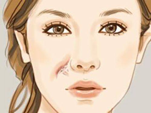 二、分项目看:不同美容项目的时间间隔与注意事项