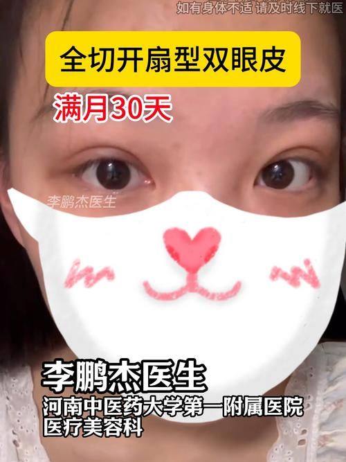 中山越华医疗美容门诊部口碑评价