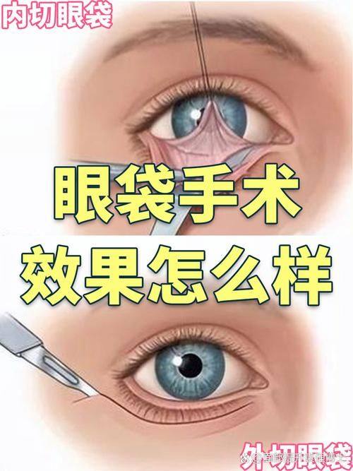 苏学峰医生怎么预约