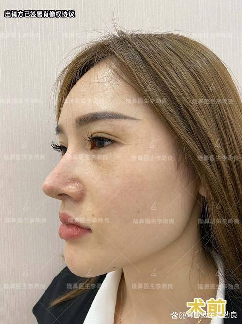 连云港薇缇医疗美容诊所怎么样？