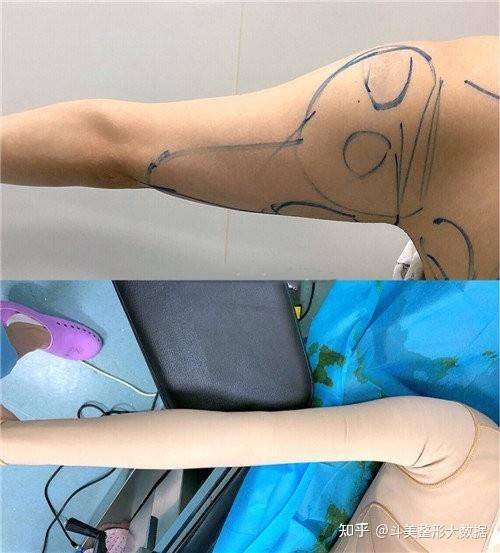 威海金政华医疗美容诊所怎么样