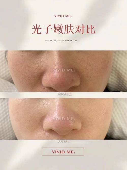 南京腋秀医疗美容门诊部价格表: