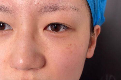 杭州美天美医疗美容擅长项目：