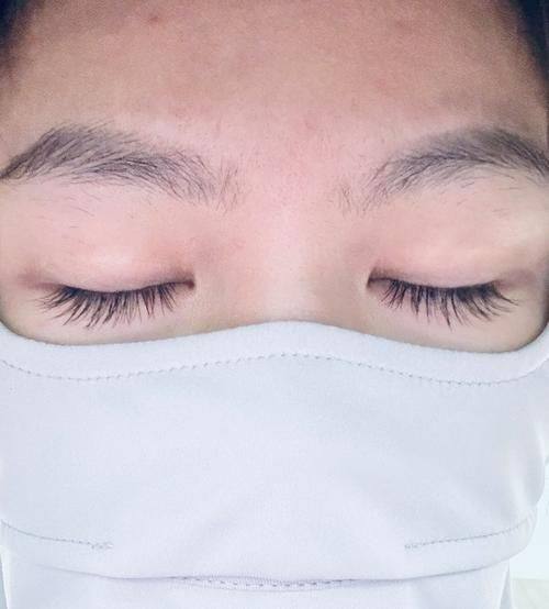 深圳爱智整形医院擅长项目: