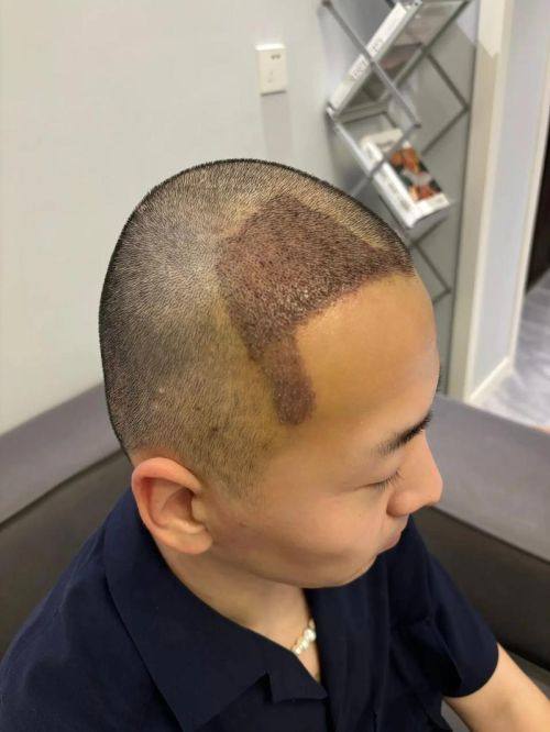 深圳爱智整形医院怎么样?