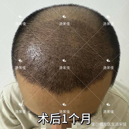 深圳爱智整形医院地址电话及营业时间