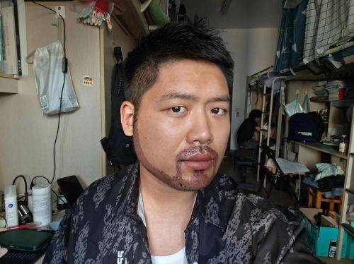 深圳爱智整形医院价格表: