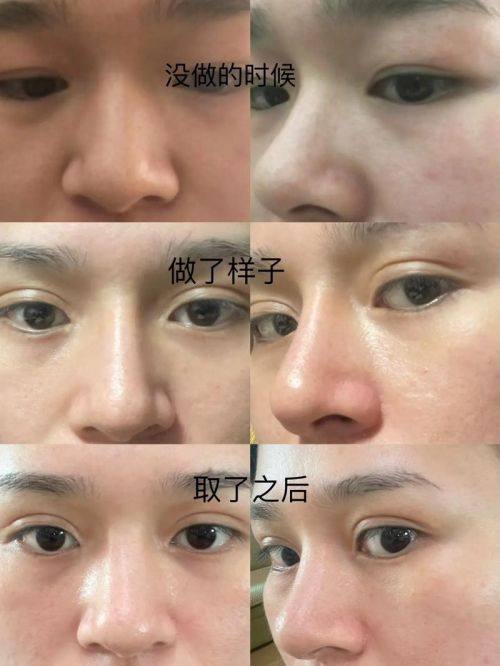 唐安医生技术优势