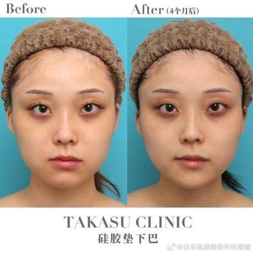 南京腋秀医疗美容门诊部地址电话及营业时间: