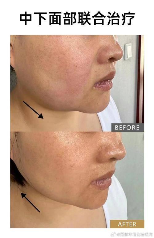 中山越华医疗美容门诊部地址电话及营业时间