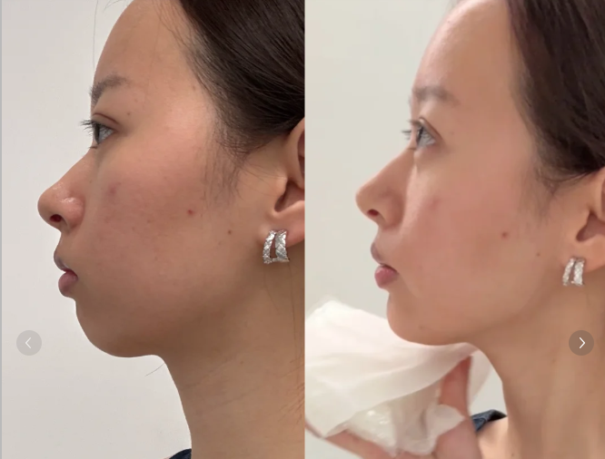 三、做好伤口清洁,预防感染不拖后腿