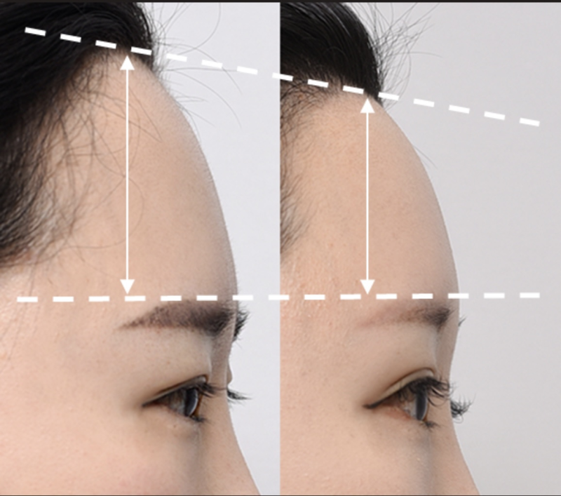 三、全脸综合性脸部护理的时间参考