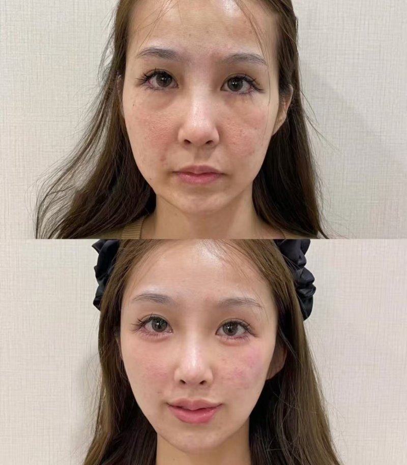 沈阳徐医生美容整形美容医院价格表：