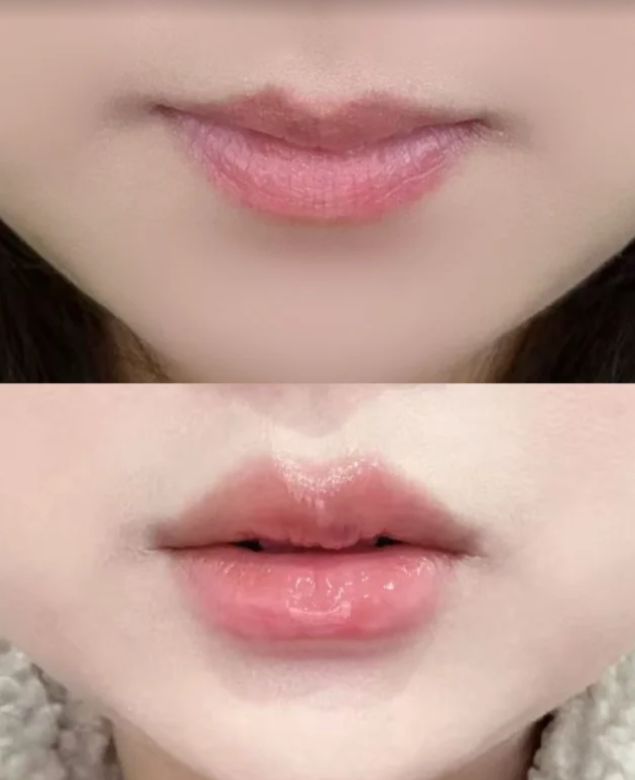 佛山广肤皮肤美容中 心预约挂号方式: