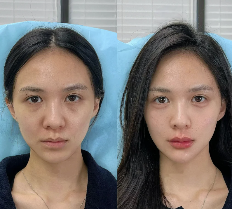 六、细节护理避坑,护航修复全程