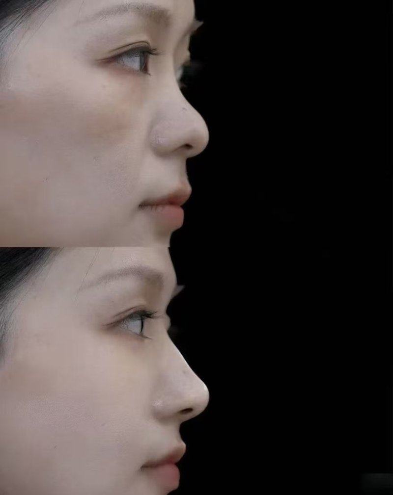 杭州西湖王圣林医疗美容整形医院预约挂号方式: