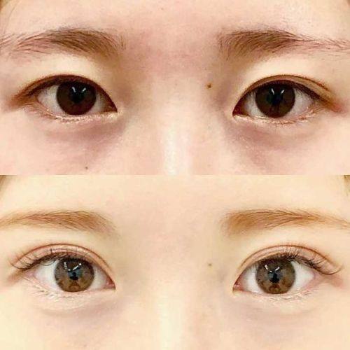 南京维美锶整形医院怎么样?