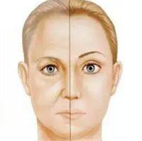 二、不同阶段疤痕疙瘩,选药有讲究