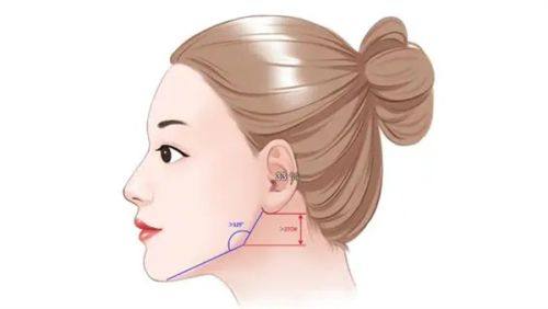 三、瘢痕体质或重度增生:几乎无法自然消退,需医学干预