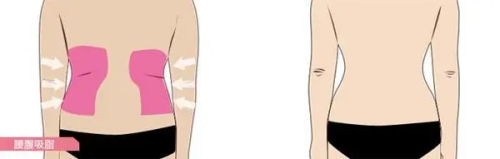 不同术后场景下的消脱止使用建议