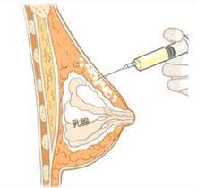 五、如何大幅降低隆鼻手术风险