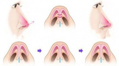 三、祛痣留疤修复,专精机构怎么选?2家靠谱参考