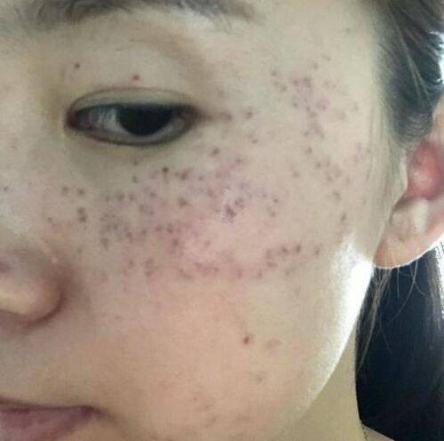 南京维美锶整形医院预约挂号方式: