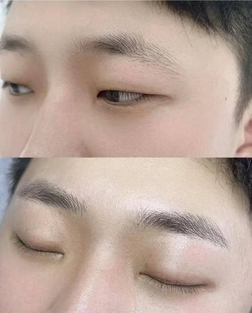 广州雍禾植发地址电话及营业时间：